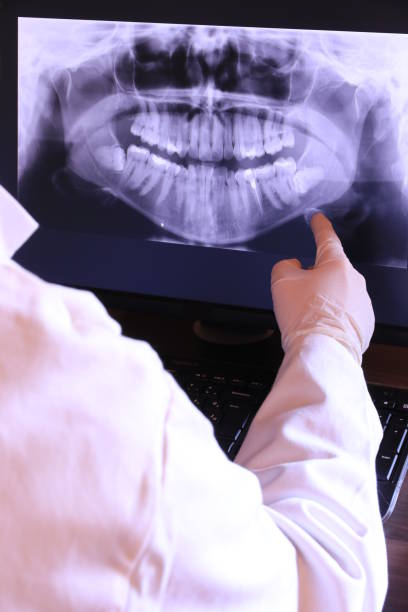 Best Broken or Cracked Tooth Emergency Dentist in College Park, GA