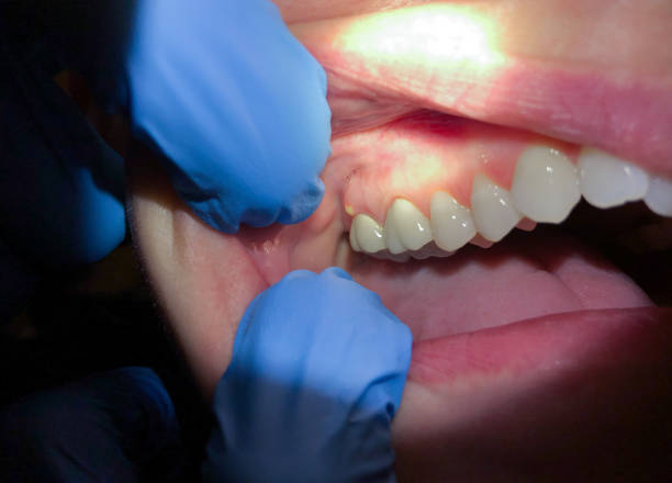 Best Emergency Dentist for Special Needs Patients in College Park, GA