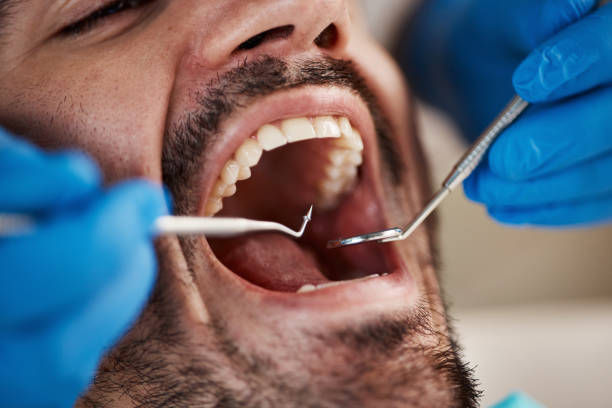 Best Mobile Emergency Dentist in College Park, GA